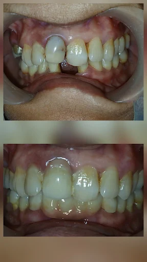 Pooja Smile Care Dental Gallery Image 32